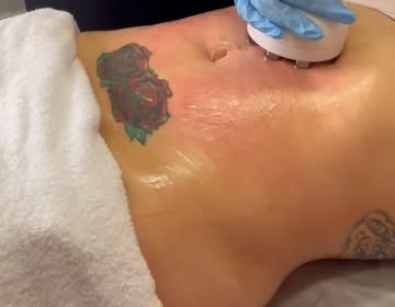 Body contouring applicator in use on a client’s abdomen